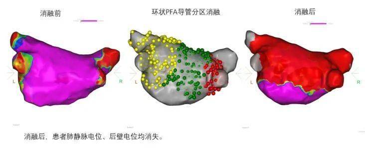 最准一码一肖100%精准_中共中央新闻发布会丨我国利用外资还将持续扩大 中国依然是各国投资的沃土